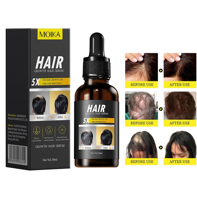 Flye Hair Growth Products Biotin Fast Growing Hair Essential Oil Hair Loss Spray Skin Nursing 30ml FLY1335 Multicolor on Productcaster.