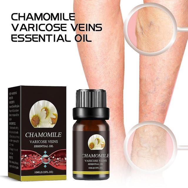 Varicose Veins Essential Oil, Chamomile Oil Varicose Veins, Chamomile Essential Oil For Varicose Veins, For Skin 1Pcs on Productcaster.