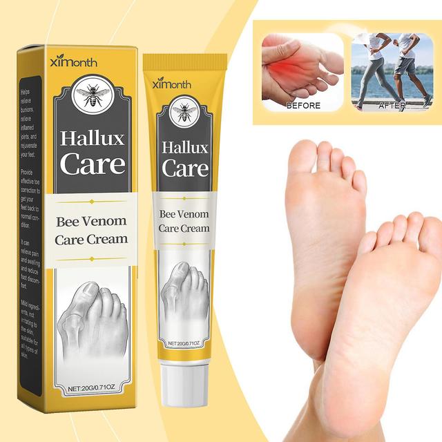 Denstyle Hallux Care Vee Venom Treatment krém Vee Venom Relief krém na nepohodlie kĺbov, vzplanutia, šľachy 2 Pcs on Productcaster.