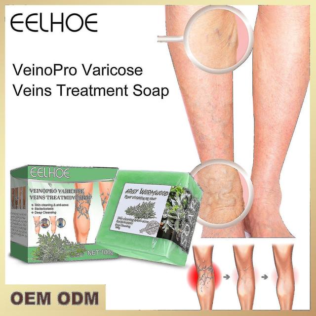 Varices Massa Débloquer Soulagement Varices Jambes Buing Worm Legs Vein Cleanse 100g Box on Productcaster.