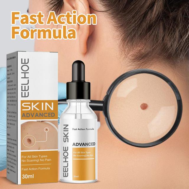 Hongyexin Serum Is Safe And Effective For Removing From Sensitive Skin 30ml on Productcaster.