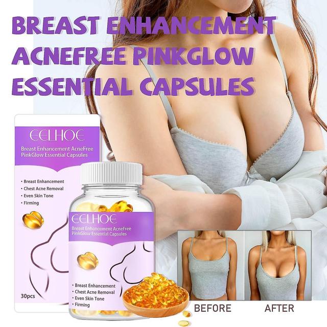 Mardi Gras Gifts Borstvergroting Acnefree Pinkglow Essentiële Capsules 28ml-hy Paars on Productcaster.