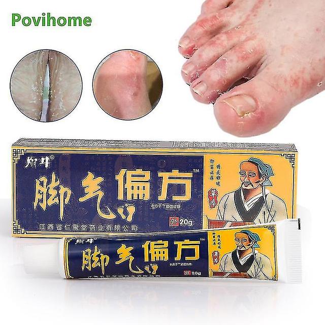 1box 20g Herbal Beriberi Treatment Cream Athlete's Foot Antibacterial Ointm on Productcaster.