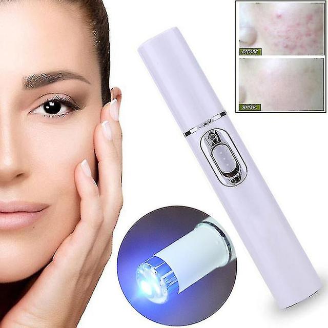 Spider Žila Guma Modré svetlo Odstránenie Guma Terapia Wrinkle Acne Akné Laserové pero Jazva on Productcaster.