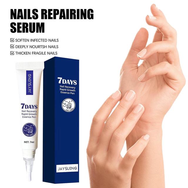 Nail Recovery Growth Essence Pen, Nail Growth Enhancement Essence Liquid, Thin Nail Growth Enhancement Oil Essence Liquid, 7ml on Productcaster.