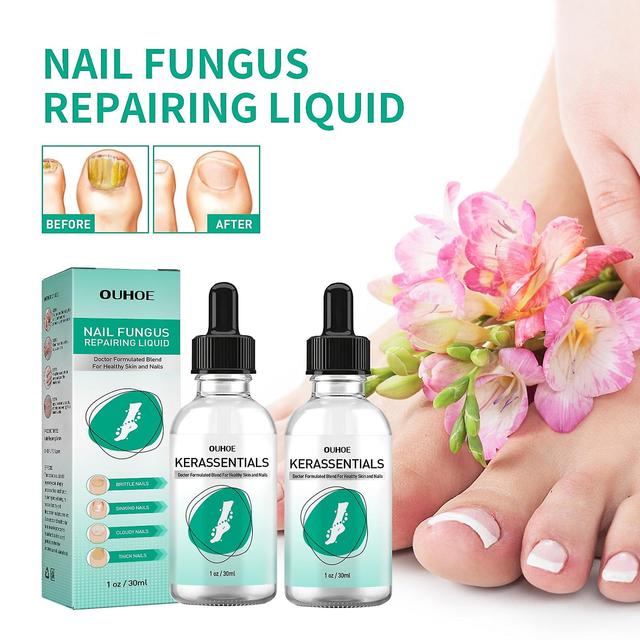 NATUREASY Extra Strength Toenail Fungus Treatment For Toenail Or Fingernail, Nail Repair Solution, Nail Renewal Liquid For Damaged & Discoloration Nai on Productcaster.