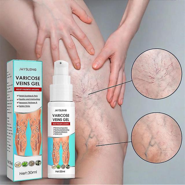 Mike 1/2pcs 30ml Varicose Vein Massage Gel Maikang Earthworm Hamstring Vein Relax Gel Relieves Leg Pain 1Pc on Productcaster.