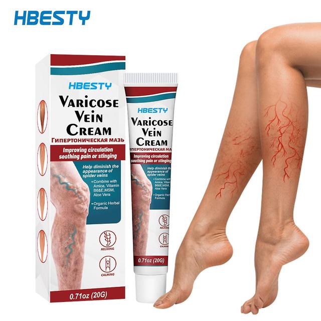 Flye Varicose Veins Cream, Vein Ointment Nanovein Cream Against Varicose Veins, Varicose Veins Cream, Strengthens Capillary Health 20g White on Productcaster.