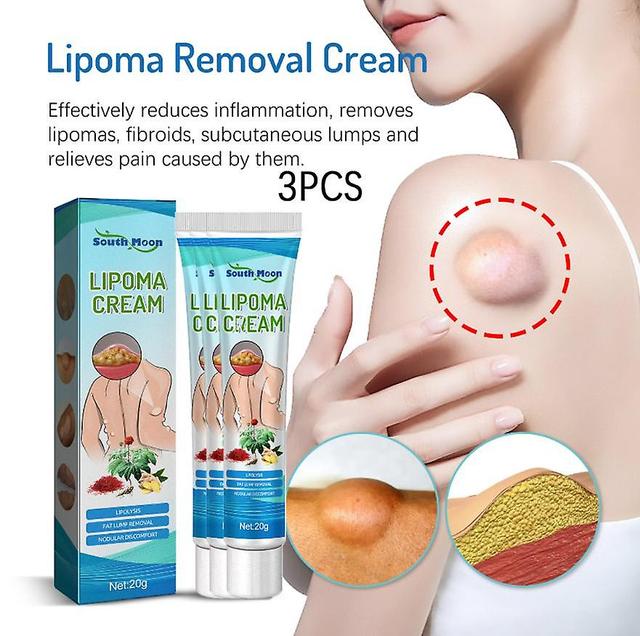 1pc South Moon Fat Accumulation Ointment Dredge The Lower Mass To Relieve Fatty Mass Body Care 3PCS on Productcaster.