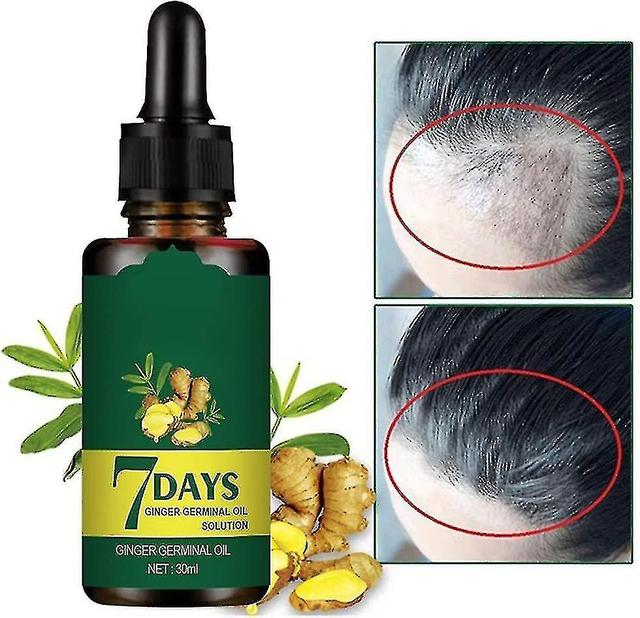 Mike Ginger Hair Growth Germinal Oil Regrow 7 Days Ginger Germinal Serum For Nourishing Hair Roots 50ml on Productcaster.