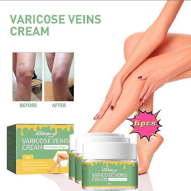 South Moon Vein Repair Cream Leg Massage Relieve Pain Repair Earthworm Leg Vein Care Cream Massage Oil1pcs) -GSL 6PCS on Productcaster.