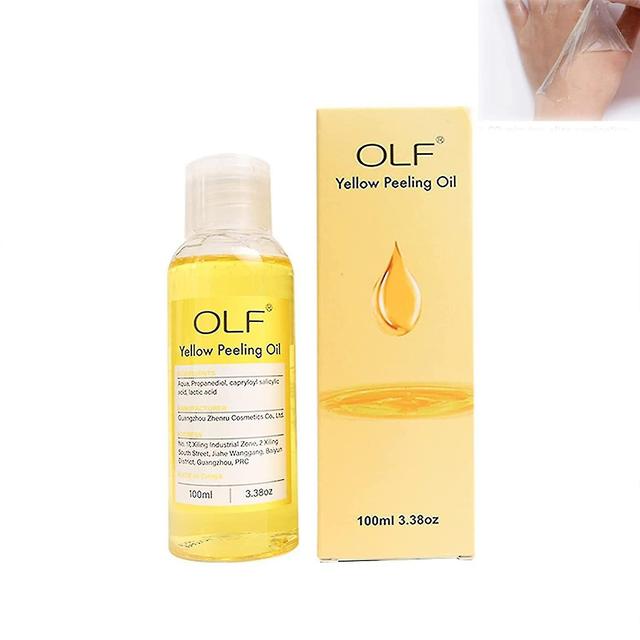 Yellow Peeling Oil, Super Strength Yellow Peeling Solution 50/100ml on Productcaster.