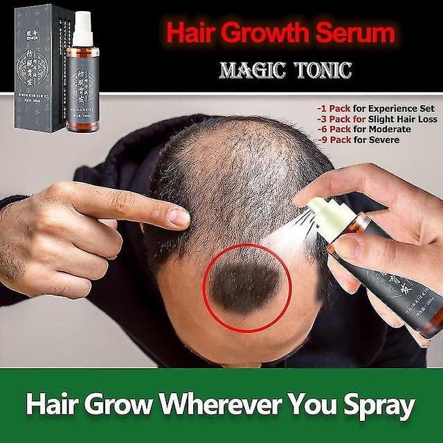 Magic Hair Regrowth Spray Essence Serum Health Hair Grow Liquid Hair Loss Ginger Hair Tonic Oil For Men Women 5ML on Productcaster.