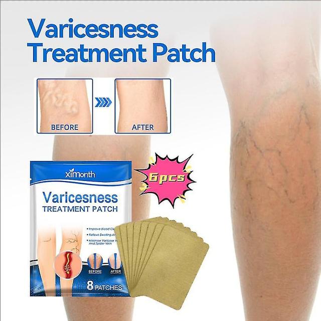 Ximonth Vein Care Patch Smoothes Blood Vessel Bulges And Massages To Relieve Leg Varicose Veins And Leg Swelling Massage Oil1pcs) -GSL 6PCS on Productcaster.