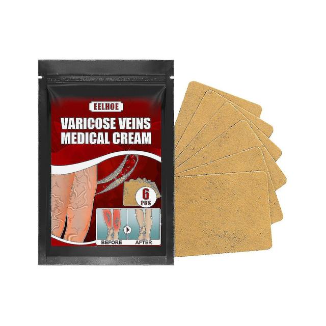 Szlwmy Eelhoe Vein Massage Varicose Plaster Patch Leg Swelling Earthworm Leg Vein -sz.4303 on Productcaster.