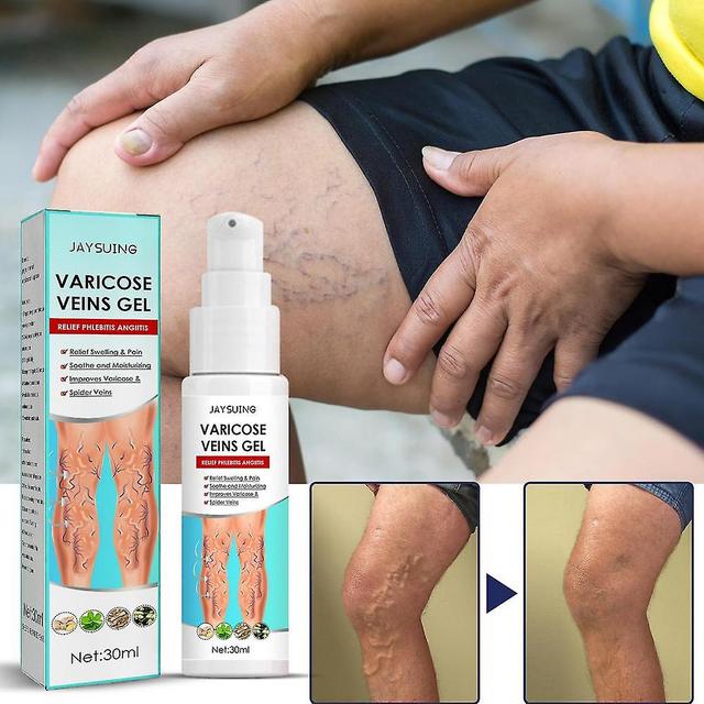 Vein Massage Varicose Gel Maikang Relieves Leg Pain Earthworm Hamstring Vein Relaxation Gel TSV 30ml box on Productcaster.