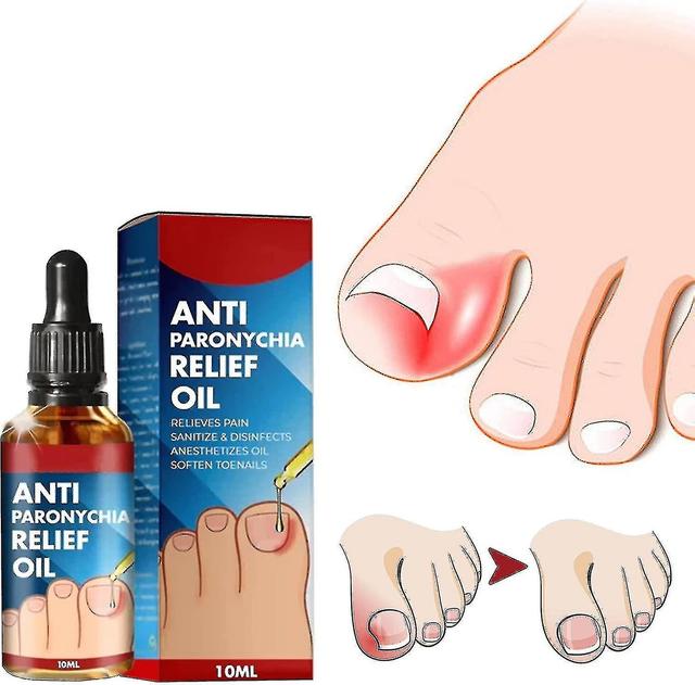 1pc Anti Paronychia Relief Oil, Ingrown Toenail Treatment, Nail Renewal Liquid For Damaged & Discoloration Nail 7packs on Productcaster.