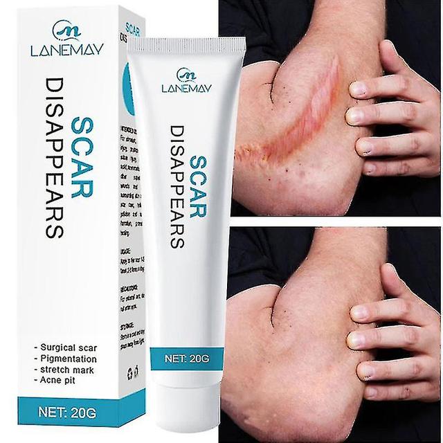 Scar And Acne Mark Removal Ointment Gel - For Wounds, Cuts And Burn High Quality High Quality on Productcaster.