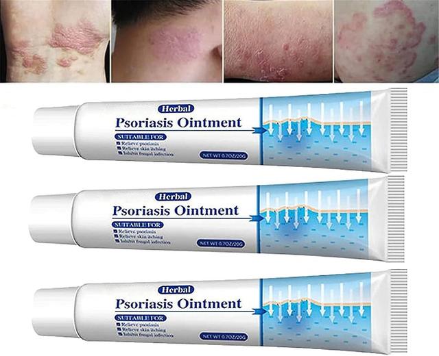 Zjrui KoT Psoriasis Cream,Psoriasis Ointment,Psoriasis Treatment,Natural Herbal Ointment for Relieve Itching 3 Pcs on Productcaster.