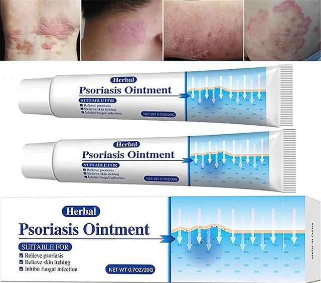 Zjrui KoT Psoriasis Cream,Psoriasis Ointment,Psoriasis Treatment,Natural Herbal Ointment for Relieve Itching 2 Pcs on Productcaster.