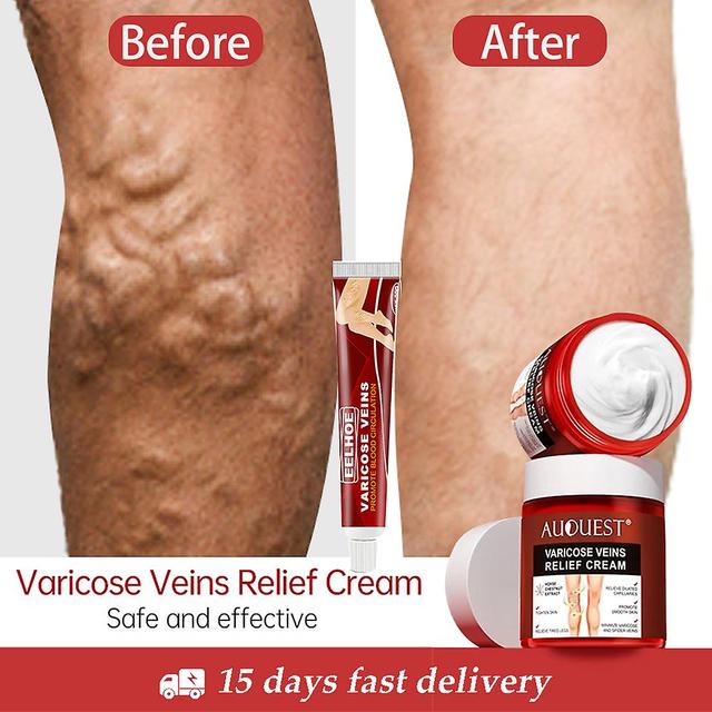 Effective Herbs Cream For Varicose Veins, Vasculitis, Phlebitis, Spider, Institutes, Ointment, Plaster Of Herbs, Beauty, Body Care, 20g 1pcs on Productcaster.