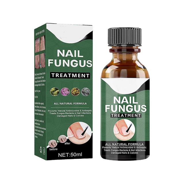 unbrand Toenail Fungus Treatment Liquid Gental Natural Ingredients Anti-Nail Fungus Liquid for Repairing 50ML on Productcaster.