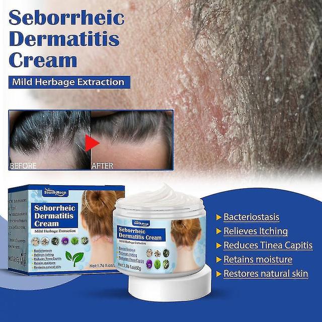 Seborrheic Skin Cream Head Acne Pruritus Hoofdhuid Ringworm Huid Probleem Repair-yay on Productcaster.