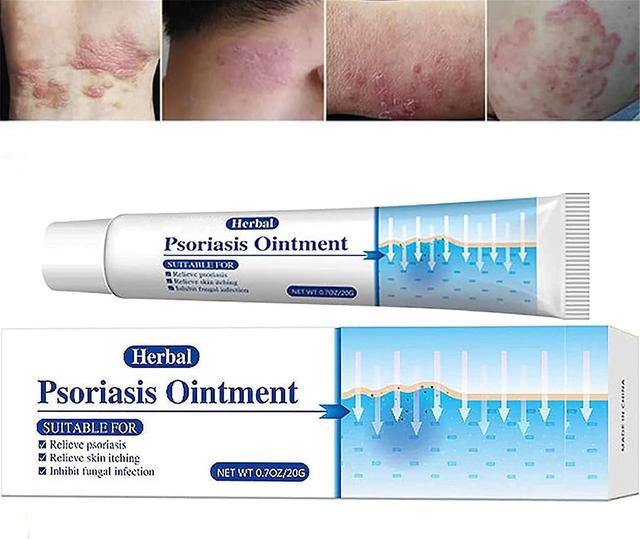 Mamusk KoT Psoriasis Cream,Psoriasis Ointment,Psoriasis Treatment,Natural Herbal Ointment for Relieve Itching 1 Pcs on Productcaster.