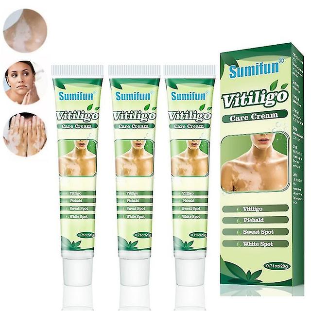 3stk urteekstrakt vitiligo salve Fjern ringorm hvid plet fjernelse hud vitiligo eliminere vitiligo behandling creme on Productcaster.