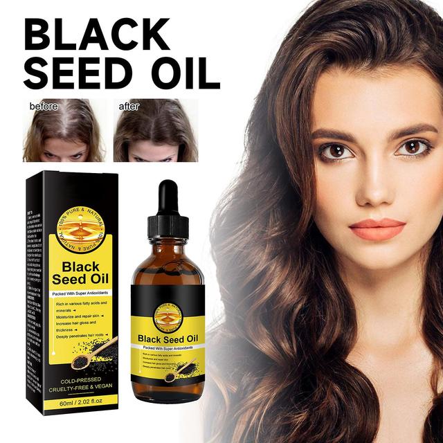 Denstyle Black Seed Oil Organic Cold Pressed,100% Pure Cold Pressed Organic Liquid Black Seed Oil With Super Antioxidant For Immune Support, Joints... on Productcaster.