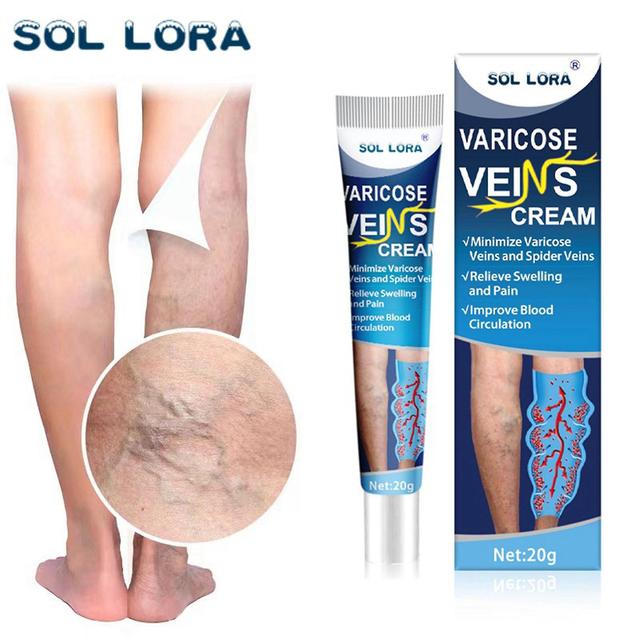 Flye Varicose Veins Cream, Vein Ointment Nanovein Cream Against Varicose Veins, Varicose Veins Cream, Strengthens Capillary Health, Improves Circul... on Productcaster.