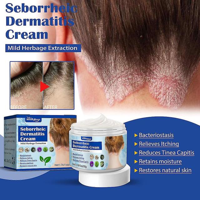 Kry Seborrheic Skin Cream Head Acne Pruritus Scalp Ringworm Skin Problem Repai Soothing Head Skin on Productcaster.