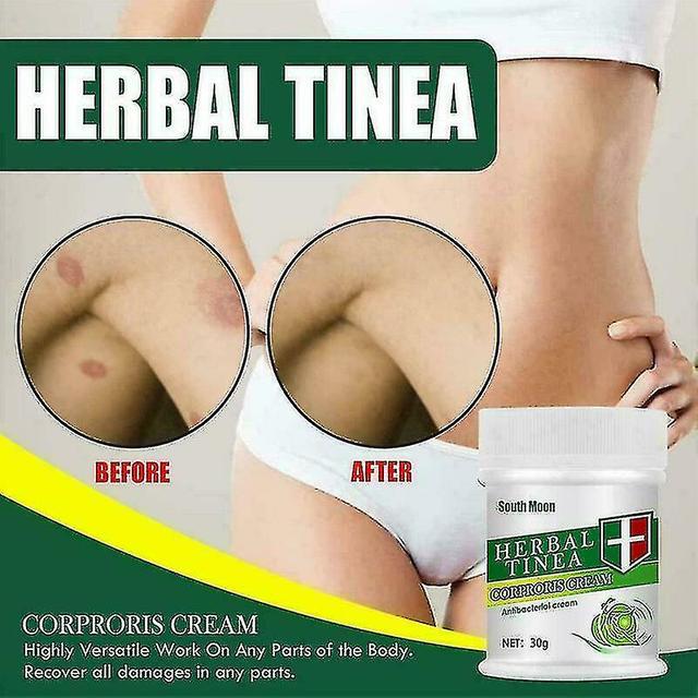 EVERYTHING ELSE Herbal Tinea Corporis Cream Tinea Skin Relief Itching Us Cream M8f6 New on Productcaster.