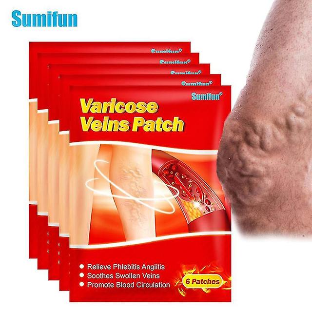 6pcs New Sumifun Varicose Veins Plaster Vasculitis Phlebitis Spider Cream Varicosity Angiitis Removal Herbal Medical Plasters on Productcaster.