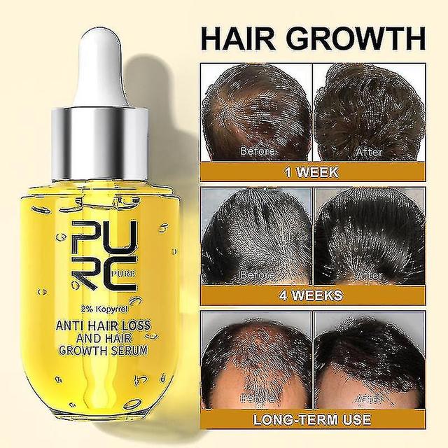 Purc Products Ginger Fast Grow Oil Anti Nourishing For Men Women Care Tw on Productcaster.