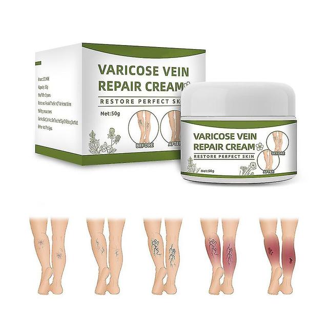 Varicose Veins Cream Natural Ointment For Varicose And Spider Veins Removal Spider Veins on Productcaster.