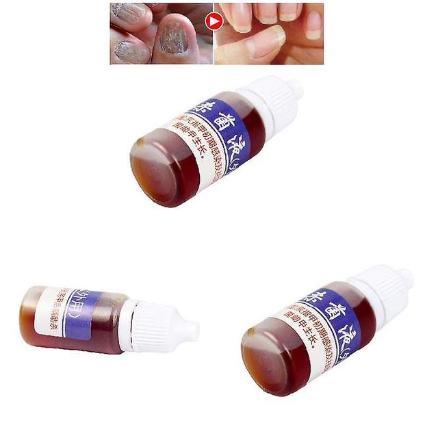 Nail Treatment Liquid Nourish Antifungal Nails Infection Chinese Herbs Liquid Grey on Productcaster.