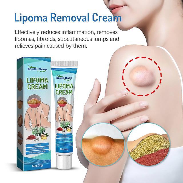 Pingguo Lipoma Removal Cream Lipoma Treat Skin Swelling Delipidation Cream on Productcaster.