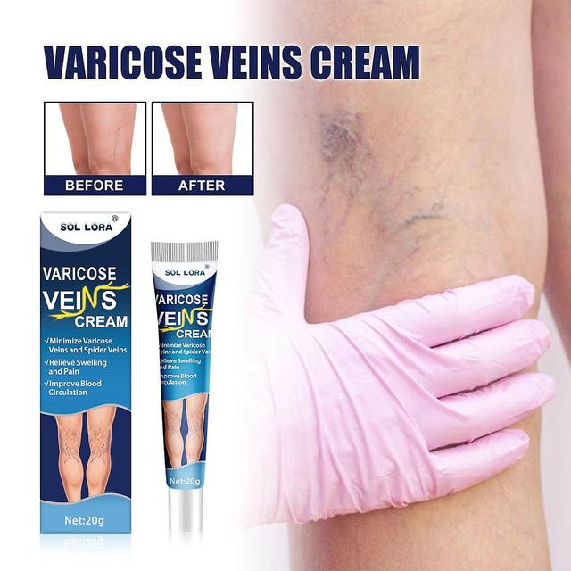 3pcs Venous Massage Varicocele Cream Relieve Leg Vascular Protruding Vein Varicocele Earthworm Leg Repair Cream -GSL on Productcaster.