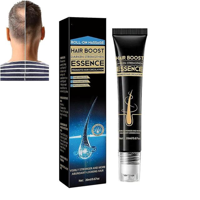 Zjrui Biotine haargroei roll-on massage essence, nieuwe natuurlijke biotine olie voor haargroei, triple roll-on massager haar groeien essence 1 Pcs on Productcaster.