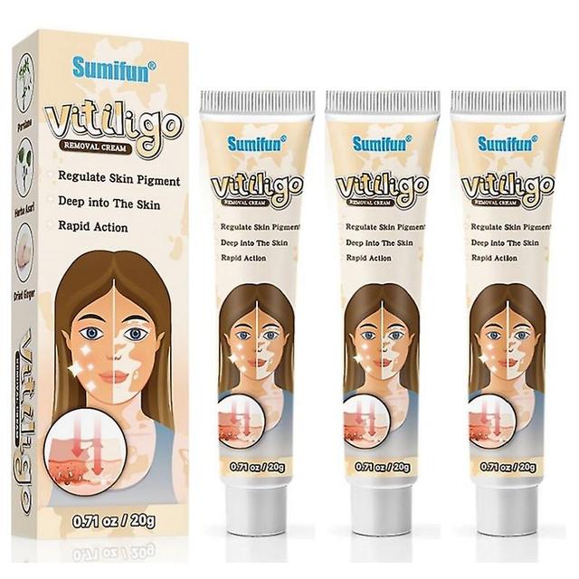 Kräuterextrakt Vitiligo-Salbe Ringelflechte entfernen weiße Flecken entfernen Haut Vitiligo beseitigen Vitiligo Behandlung Creme on Productcaster.