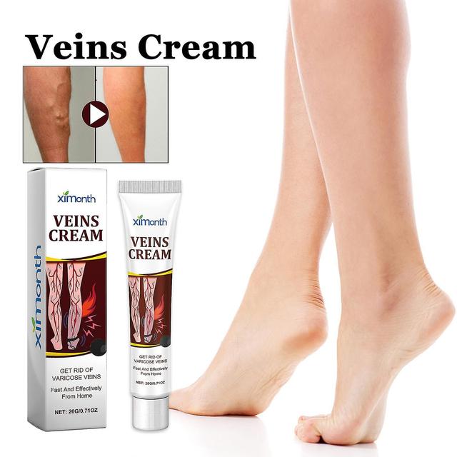 Snxijv Crème de soulagement des varices, crème anti-varices naturelle pour les varices et les varicosités, soulagement des varices pour les jambes,... on Productcaster.