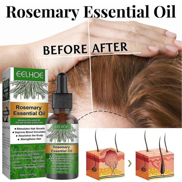 30ml H Oil Nourishment Scalp Stimulates H H Care Oil on Productcaster.