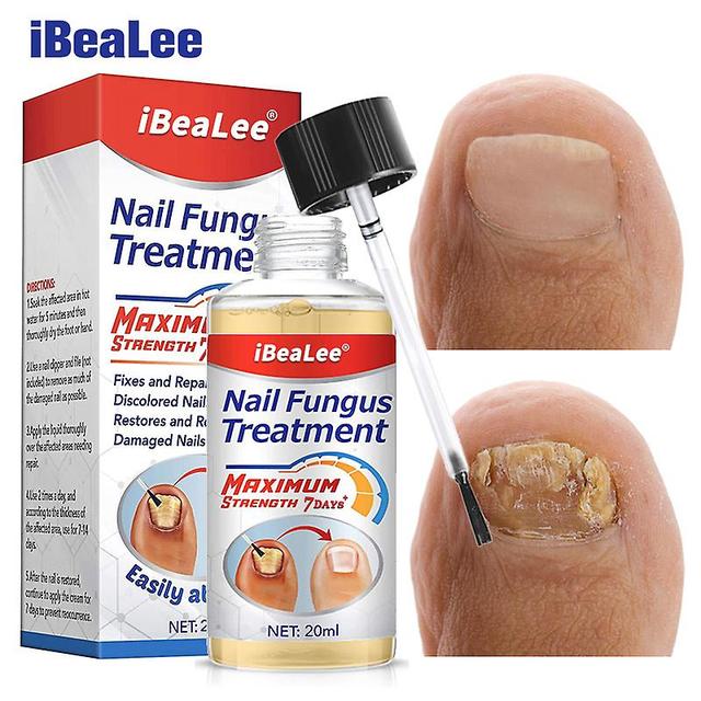 Ibealee-training Of The Nauts, Repaintiving Fuster, Anti-infection, Feet Care, Antifungal Frost, Onychomycosis Oil, 7 Days, 10 Pieces 10PCS on Productcaster.