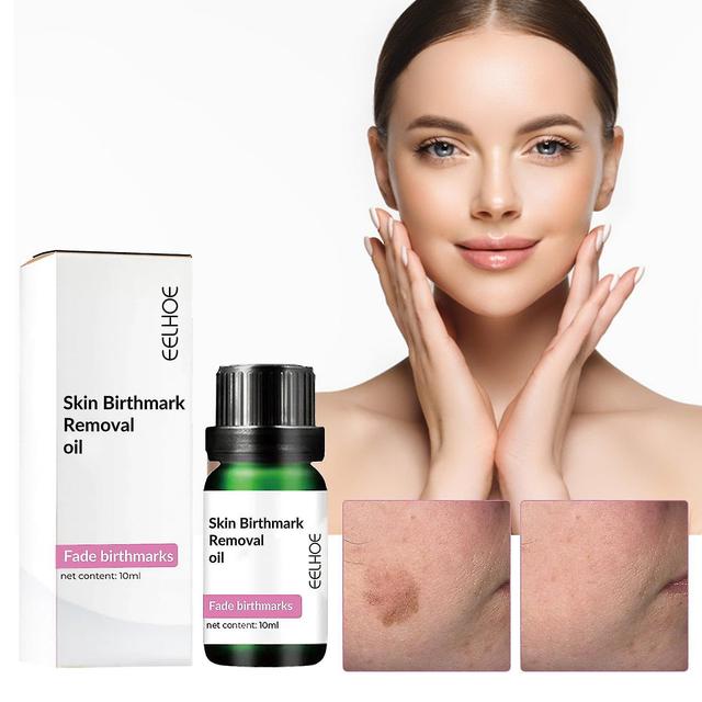 Mysept Birthmark Removal Oil - Lighten Birthmarks and Pigmentation on Productcaster.