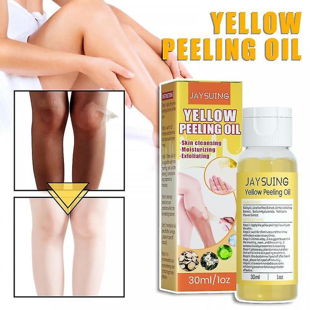 Yalo Peeling Oil Super Strength Yellow Peeling Oil Super Strength Yellow Peeling Oil Lightening on Productcaster.