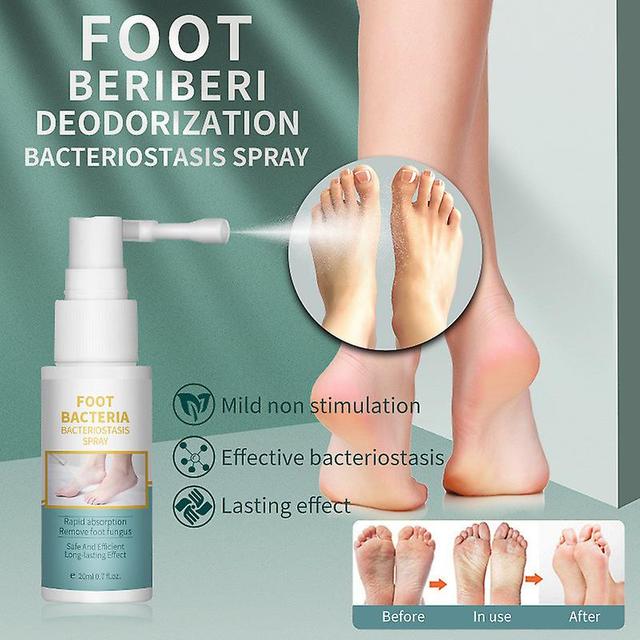 Flye Athlete's Foot Spray, Natural Athletes Foot Spray, Liquid Itch Relief Essential Oil Feet Refreshing Extra Strengt20ml Multicolor on Productcaster.