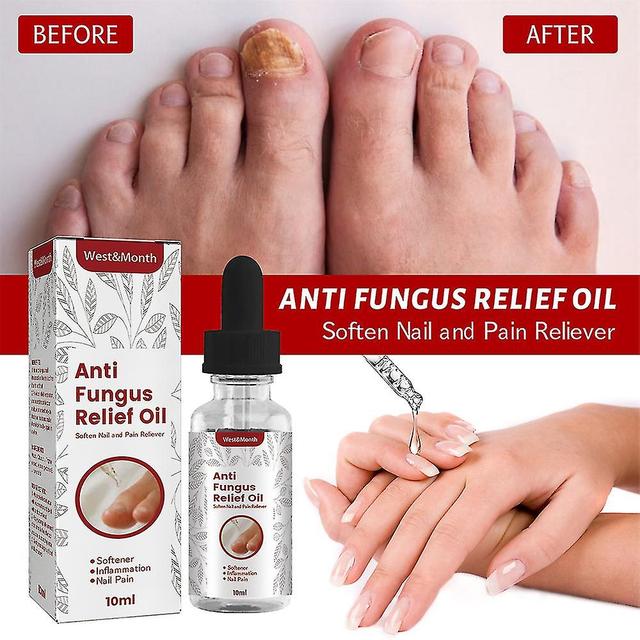 Yalo Onychomycosis Oil Recover Nail Treatment Health Toenail Rapid Relief Treatment on Productcaster.