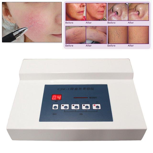 High Frequency Spider Veins Removal Anti Redness Machine Red Blood Vessel New on Productcaster.