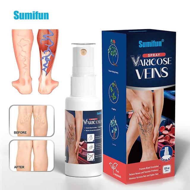 Temu Vein Spray Qu Zhang Vascular Bulge Smoothing Earthworm Leg Leg Spray K50001 on Productcaster.